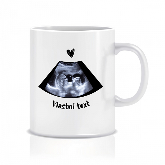 Personalizovaný klasický bílý keramický hrníček 300 ml s ultrazvukem