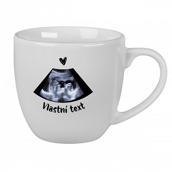 Personalizovaný keramický hrníček 400 ml s ultrazvukem