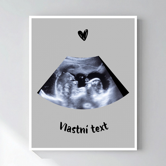 Personalizovaný magický fotoobraz v rámu - 50x70 - ultrazvuk